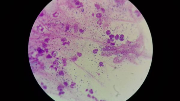 Otitis externa med Pseudomonas spp. hos hund - Hunde - Fagmagasinet DYRLÆGEN