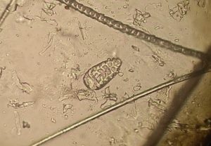 Demodex gatoi hos kat