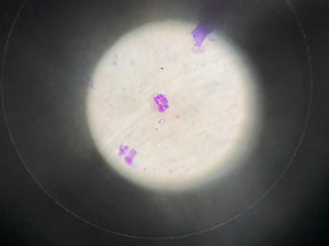 Figur 6 - Eosinofil granulocyt fra sår i ansigtet hos kat.