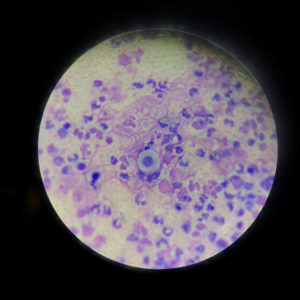 Figur 1 – Akantolytisk celle fra pustel hos hund med pemphigus foliaceus (Foto: Anne Aagaard Nielsen).